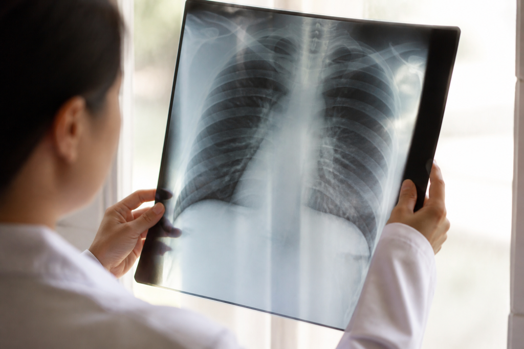 Films radiographiques montrant couches sensibles argent metallique